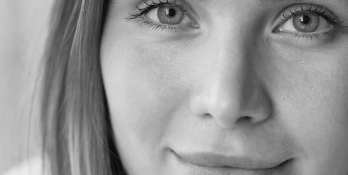 Augenlidstraffung Blepharoplastik